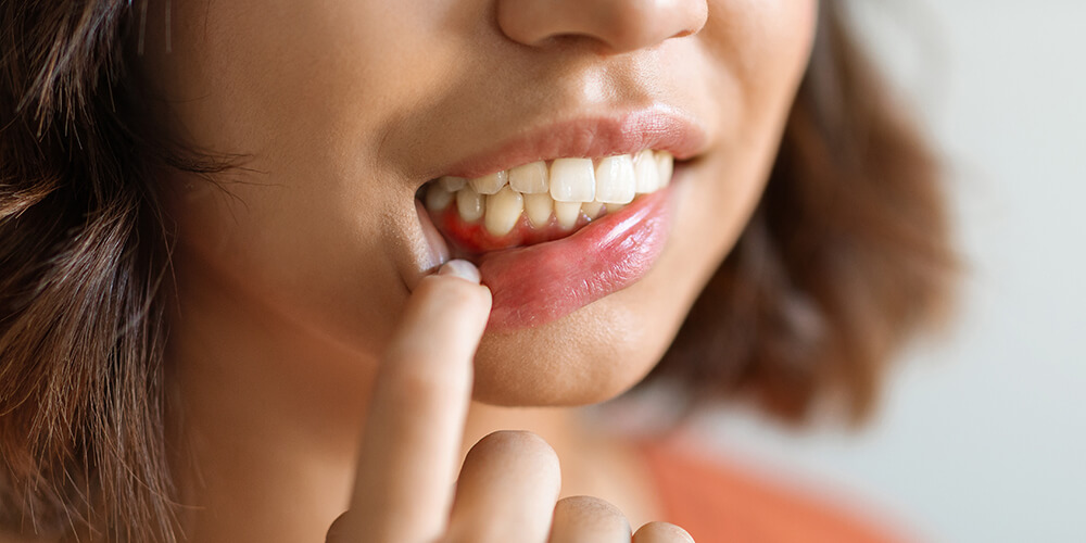 Periodontal Therapy Newport Beach